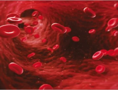 Tαξίδια και θρομβοεμβολικό επεισόδιο: Συμπτώματα και τι να προσέχετε